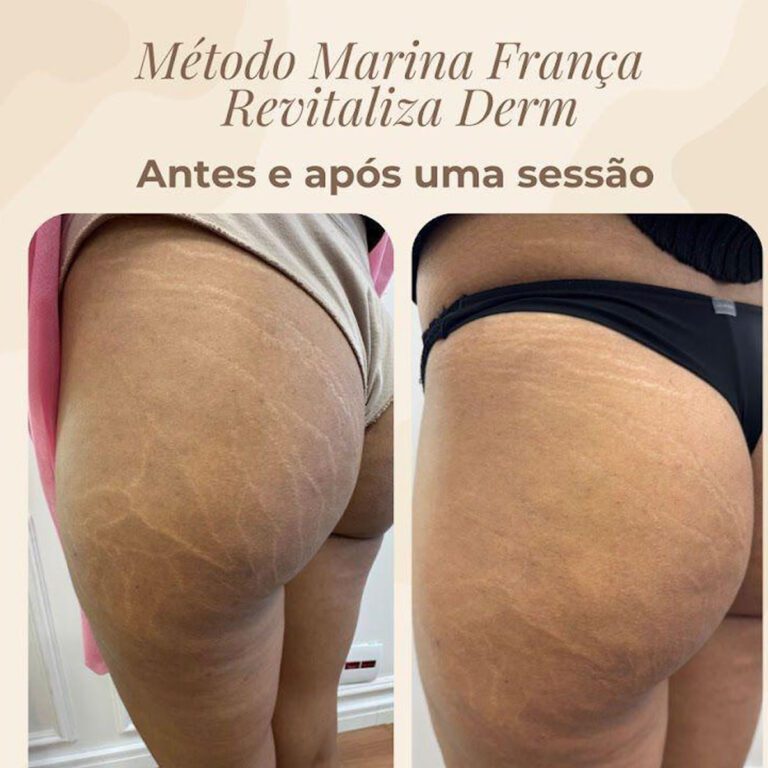 homeestrias